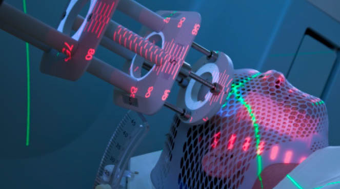 Man Receiving Radiotherapy (Radiation Therapy) for Cancer Treatment [url=http://www.istockphoto.com/file_search.php?action=file&lightboxID=6833324] [img]http://www.kostich.com/cancer.jpg[/img][/url]